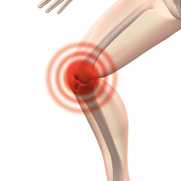 Απεικόνιση πόνου σε γόνατο